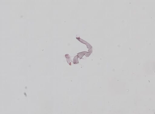 Hyalella cf. azteca