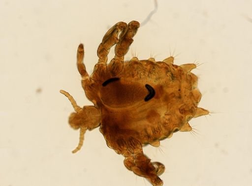Pthirus pubis