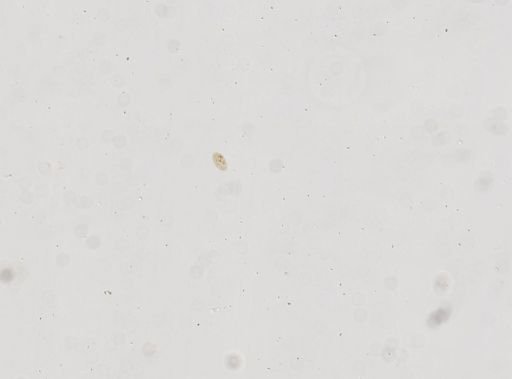 Paramecium polycaryum
