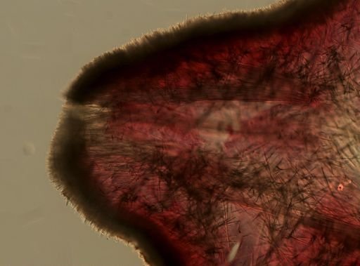 Radiella