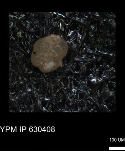 undet. Rugoglobigerinidae