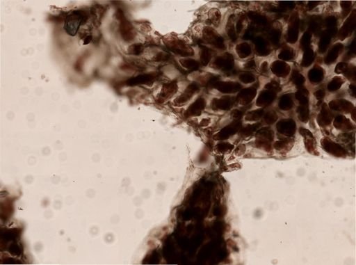 Alcyonidium variegatum