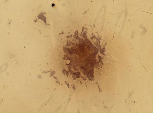 Clepsidrina polymorpha