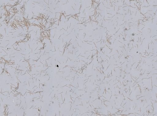 Amphimedon compressa