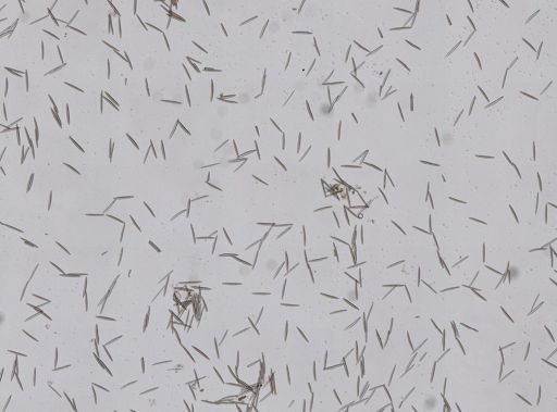 Haliclona oculata