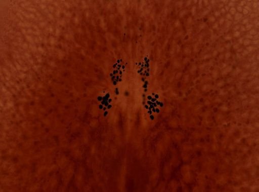 Pleioplana atomata