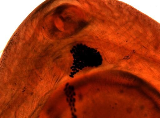 Fasciolopsis buski