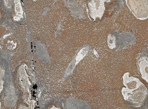 Taenia crassicollis