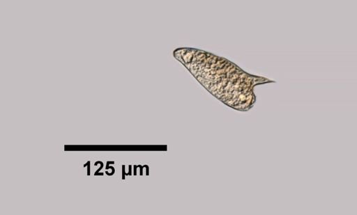 Schistosoma mansoni
