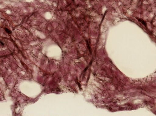 Ircinia
