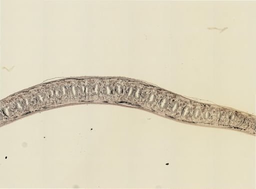 Turbellaria