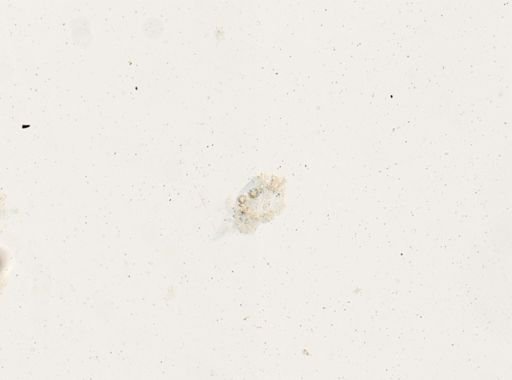 Schistosoma mansoni