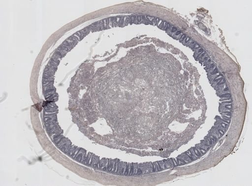 Eimeria meleagrimitis