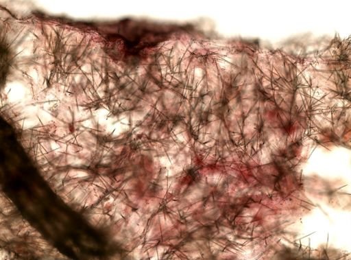 Lissodendoryx (Ectyodoryx) sp.
