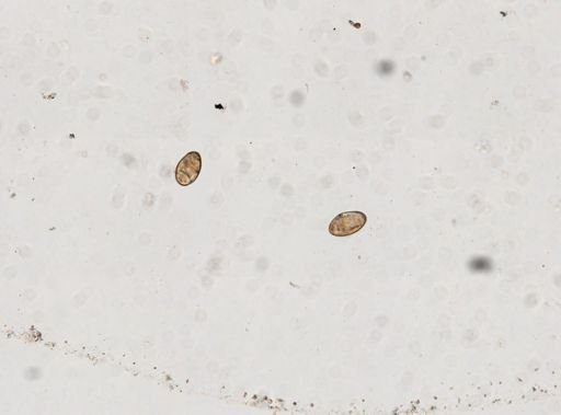 Fasciolopsis buski