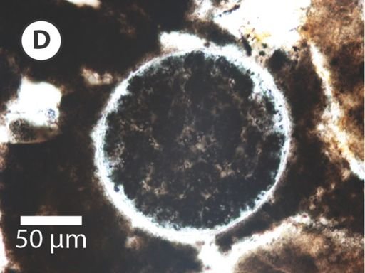 Megasphaera miniscula