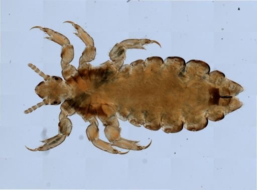 Pediculus humanus
