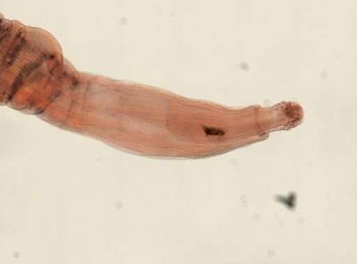 Oligacanthorhynchus microcephalus