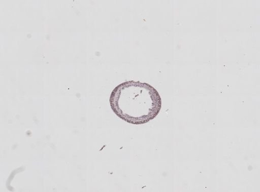 Hydra oligactis