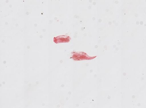 Artemia