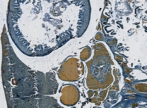 Ichthyosporidium