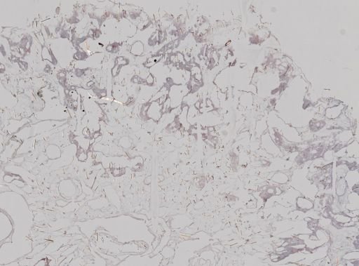 Stromatospongia vermicola