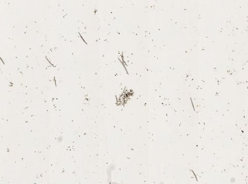 Trochospongilla pennsylvanica