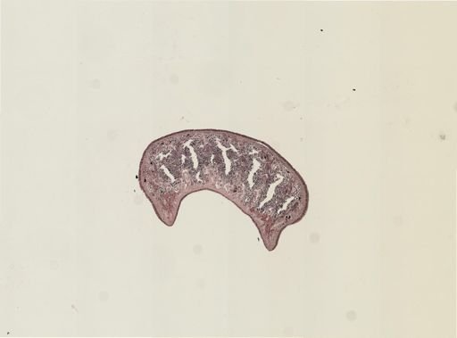Foviella