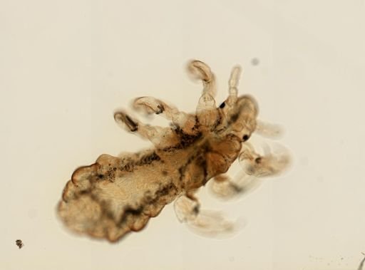 Pediculus humanus