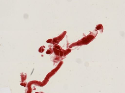 Digenea