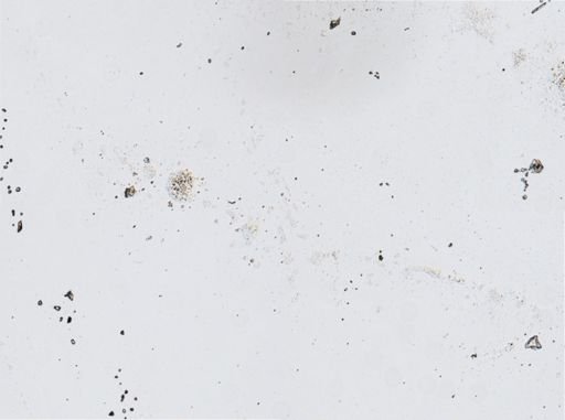 Licnophora?