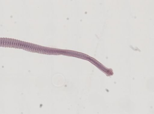 Hymenolepis nana