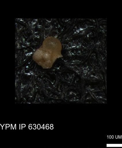 undet. Rugoglobigerinidae