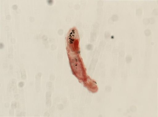 Dinophilus gyrociliatus