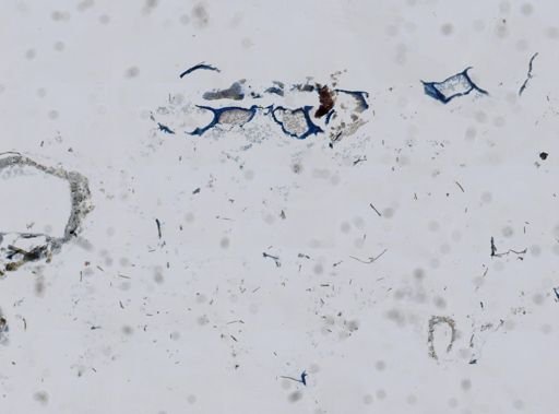 Chalinula loosanoffi