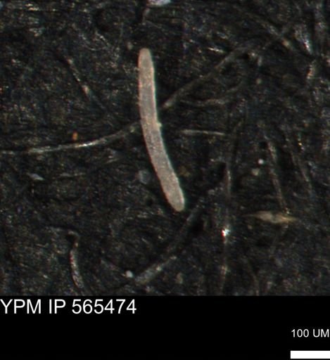 undet. Porifera