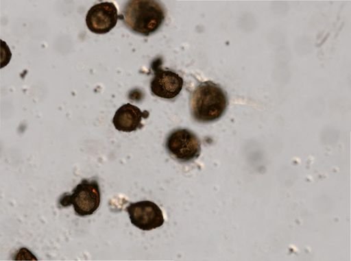 Rotifera