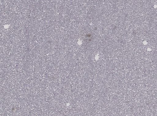 Plasmodium relictum matutinum