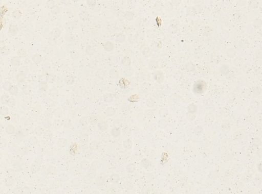 Schistosoma japonicum