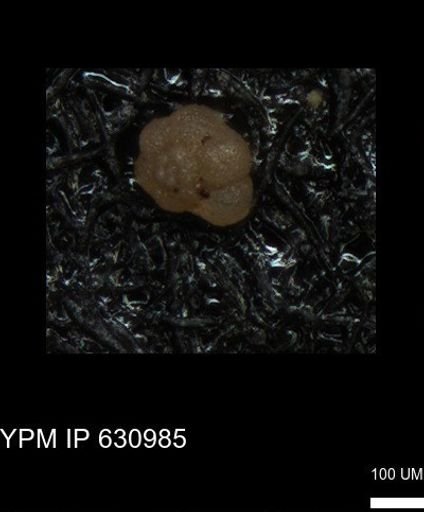 undet. Globigerinina