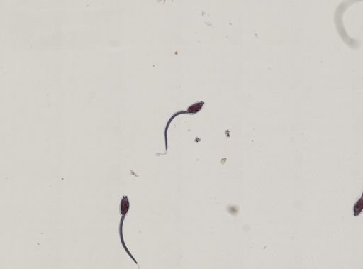 Tunicata