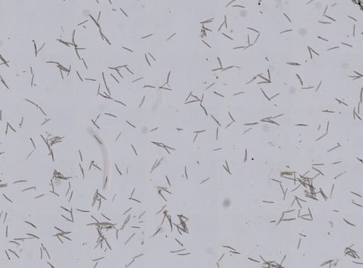 Haliclona oculata