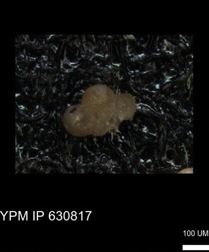 undet. Globigerinina