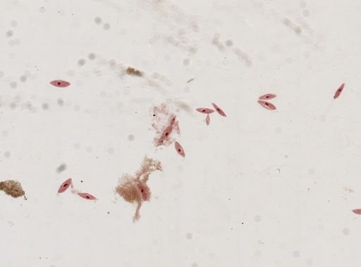 Paramecium