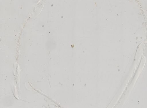 Paramecium