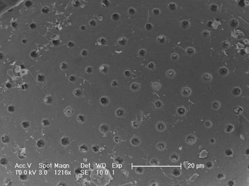 Globorotalia inflata