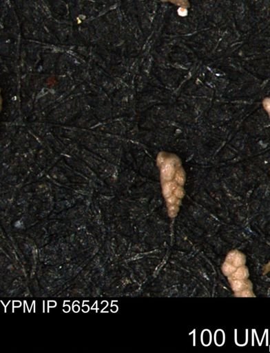 Verneuilina canadensis
