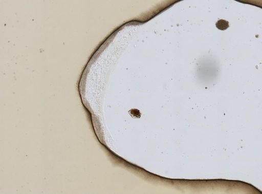 Ploesoma lenticulare
