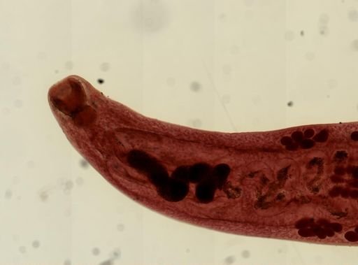 Ostiolum medioplexus