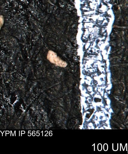 Verneuilina canadensis